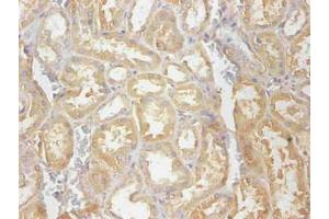 Immunohistochemical of paraffin-embedded human kidney tissue using ABIN7148973 at dilution of 1:200 (CST3 antibody)