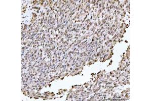 IHC analysis of DHX15/prp43 using anti-DHX15/prp43 antibody (ABIN7602738). (DHX15 antibody  (C-Term))