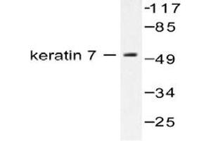 Image no. 2 for anti-Keratin 7 (KRT7) antibody (ABIN265502) (Cytokeratin 7 antibody)