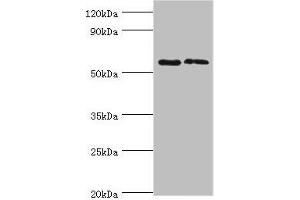 Western blot All lanes: Alkaline phosphatase, placental type antibody at 6 μg/mL Lane 1: A549 whole cell lysate Lane 2: Hela whole cell lysate Secondary Goat polyclonal to rabbit IgG at 1/10000 dilution Predicted band size: 58 kDa Observed band size: 58 kDa (PLAP antibody  (AA 260-520))