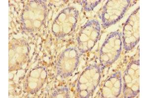 Immunohistochemistry of paraffin-embedded human colon tissue using ABIN7169844 at dilution of 1:100 (SGTB antibody  (AA 14-304))
