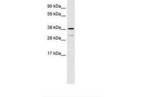 Image no. 1 for anti-Vacuolar Protein Sorting 72 Homolog (S. Cerevisiae) (VPS72) (AA 179-228) antibody (ABIN6735920) (VPS72 antibody  (AA 179-228))