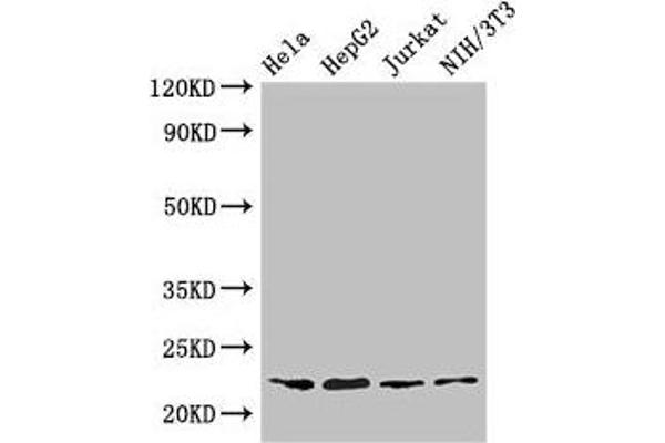 RPS5 anticorps  (AA 1-204)