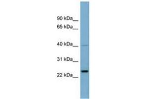 Image no. 1 for anti-Nucleolar Protein 16 (NOP16) (AA 71-120) antibody (ABIN6741999) (NOP16 antibody  (AA 71-120))