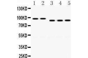 Western Blotting (WB) image for anti-Discs, Large Homolog 4 (Drosophila) (DLG4) (AA 581-724) antibody (ABIN3043563) (DLG4 antibody  (AA 581-724))