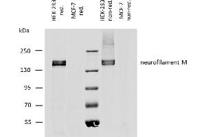 NEFM antibody