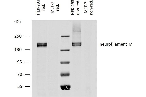 NEFM antibody