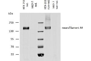 Western blotting analysis of human neurofilament M protein using mouse monoclonal antibody NF-09 on lysates of HEK-293 cell line, and MCF-7 cell line (neurofilament non-expressing cell line, negative control) under reducing and non-reducing conditions. (NEFM antibody)