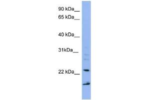 WB Suggested Anti-IMP3 Antibody Titration: 0. (IMP3 antibody  (Middle Region))