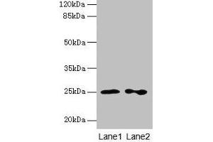 Western blot All lanes: RAB11B antibody at 2 μg/mL Lane 1: Hela whole cell lysate Lane 2: Rat gonadal tissue Secondary Goat polyclonal to rabbit IgG at 1/10000 dilution Predicted band size: 25, 20 kDa Observed band size: 25 kDa (RAB11B antibody  (AA 2-215))