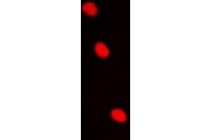 Immunofluorescent analysis of AES staining in Hela cells. (AES antibody)