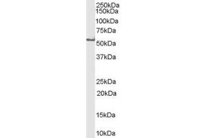 Western Blotting (WB) image for anti-F-Box Protein 43 (FBXO43) (C-Term) antibody (ABIN2465649) (FBXO43 antibody  (C-Term))