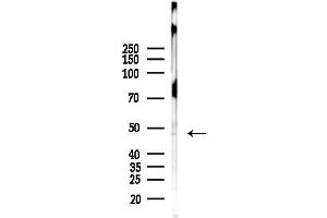 anti-Solute Carrier Family 16, Member 14 (Monocarboxylic Acid Transporter 14) (SLC16A14) (Internal Region) antibody