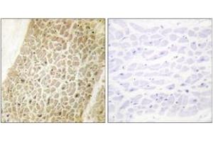 Immunohistochemistry analysis of paraffin-embedded human heart tissue, using AKAP8 Antibody.