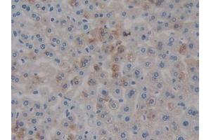 Detection of COMP in Mouse Liver Tissue using Polyclonal Antibody to Cartilage Oligomeric Matrix Protein (COMP) (COMP antibody  (AA 554-753))