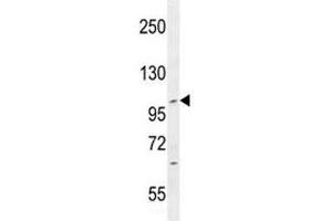 IFT88 antibody western blot analysis in CEM lysate. (IFT88 antibody  (AA 791-820))