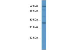 WB Suggested Anti-FGFR2  Antibody Titration: 0.