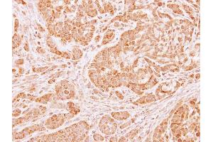 Immunohistochemistry (IHC) image for anti-Leucyl-tRNA Synthetase 2, Mitochondrial (LARS2) antibody (ABIN2856733)