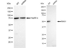 Western blotting analysis using RING1 antibody (ABIN7800240). (Recombinant RING1 antibody)