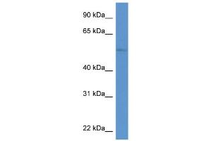 WB Suggested Anti-ZIC3 Antibody Titration:  0.