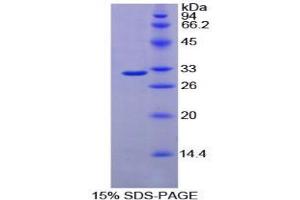 SDS-PAGE analysis of Mouse Fucosyltransferase 4 Protein.