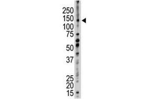 Image no. 1 for anti-Ubiquitin Conjugation Factor E4 B (UBE4B) (N-Term) antibody (ABIN357483) (UBE4B antibody  (N-Term))