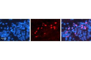 RORA antibody - middle region          Formalin Fixed Paraffin Embedded Tissue:  Human Pineal Tissue    Observed Staining:  Nucleus in Human Pineal Tissue   Primary Antibody Concentration:  1:100    Other Working Concentrations:  1/600    Secondary Antibody:  Donkey anti-Rabbit-Cy3    Secondary Antibody Concentration:  1:200    Magnification:  20X    Exposure Time:  0. (RORA antibody  (Middle Region))