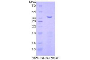 SDS-PAGE (SDS) image for Matrix Metallopeptidase 7 (Matrilysin, Uterine) (MMP7) (AA 1-264) protein (His tag) (ABIN2125827)
