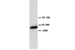 Western blot analysis of Hela cell lysis using Annexin VI antibody