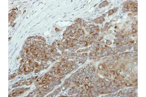 IHC-P Image Immunohistochemical analysis of paraffin-embedded Cal27 xenograft, using NR0B1, antibody at 1:100 dilution.