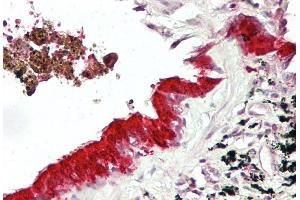 IHC Suggested Anti-MXI1 antibody  Titration: 5ug/ ml Positive Control: Lung, respiratory epithelium (MXI1 antibody  (Middle Region))