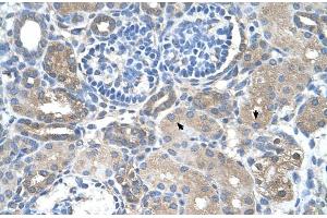 Rabbit Anti-SARDH Antibody  Paraffin Embedded Tissue: Human Kidney Cellular Data: Epithelial cells of renal tubule Antibody Concentration: 4. (SARDH antibody  (Middle Region))