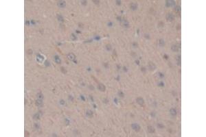 IHC-P analysis of Rat Tissue, with DAB staining. (TGM1 antibody  (AA 504-737))