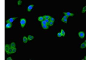 Immunofluorescent analysis of HepG2 cells using ABIN7143891 at dilution of 1:100 and Alexa Fluor 488-congugated AffiniPure Goat Anti-Rabbit IgG(H+L) (ALKBH4 antibody  (AA 1-115))