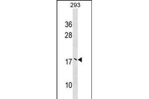 UBE2V2 Antibody (Center) (ABIN1538606 and ABIN2848850) western blot analysis in 293 cell line lysates (35 μg/lane). (UBE2V2 antibody  (AA 75-104))