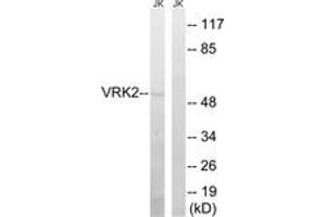 Western blot analysis of extracts from Jurkat cells, using VRK2 Antibody. (VRK2 antibody  (AA 171-220))