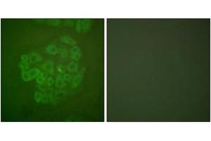 Immunofluorescence analysis of A549 cells, using GR (Ab-211) Antibody. (GR (AA 181-230) antibody)