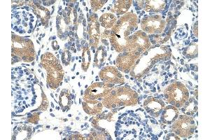 ApoBEC3D antibody was used for immunohistochemistry at a concentration of 12. (APOBEC3D antibody)