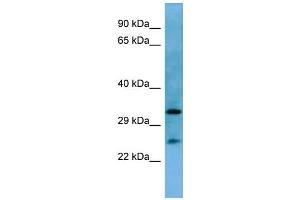 Western Blotting (WB) image for anti-Homeobox A6 (HOXA6) (N-Term) antibody (ABIN2779766) (HOXA6 antibody  (N-Term))