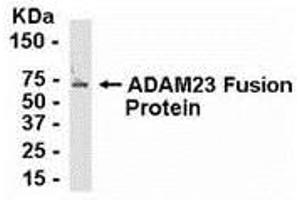 Western Blotting (WB) image for anti-ADAM Metallopeptidase Domain 23 (Adam23) (AA 72-144) antibody (ABIN2467991) (Adam23 antibody  (AA 72-144))