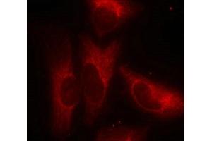 Immunofluorescence staining of methanol-fixed Hela cells using 14-3-3z(Phospho-Ser58) Antibody. (14-3-3 zeta antibody  (pSer58))