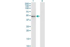 Western Blot analysis of ZMYND10 expression in transfected 293T cell line by ZMYND10 monoclonal antibody (M05), clone 3A6. (ZMYND10 antibody  (AA 1-440))