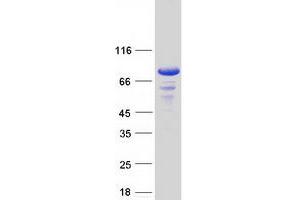 Validation with Western Blot (BMX Protein (Transcript Variant 2) (Myc-DYKDDDDK Tag))
