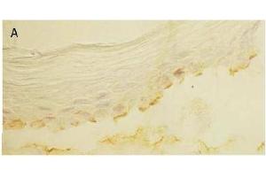 Immunohistochemistry (IHC) image for anti-Laminin 5 (LN-5) antibody (ABIN191945) (Laminin 5 antibody)