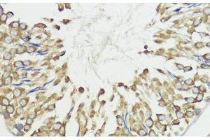 Immunohistochemistry of paraffin-embedded Rat testis using HACE1 Polyclonal Antibody at dilution of 1:100 (40x lens). (HACE1 antibody)