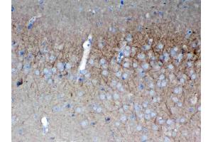 IHC analysis of SAP102 using anti-SAP102 antibody . (DLG3 antibody  (AA 749-817))