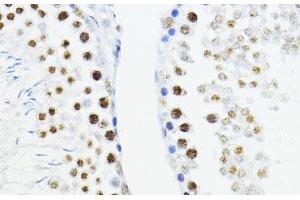 Immunohistochemistry of paraffin-embedded Rat testis using ZEB1 Polyclonal Antibody at dilution of 1:200 (40x lens). (ZEB1 antibody)