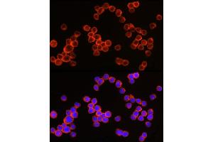 Immunofluorescence analysis of THP-1 cells using CD64 Rabbit pAb (ABIN3021694, ABIN3021695, ABIN3021696 and ABIN6215530) at dilution of 1:50 (40x lens). (FCGR1A antibody  (AA 200-292))