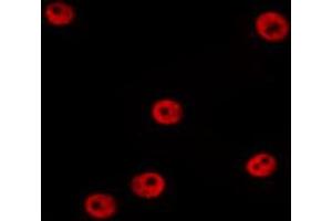 ABIN6274381 staining HepG2 by IF/ICC. (MAPK6 antibody  (Internal Region))