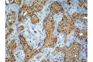 Generously provided by Markus Linder from Medical University Vienna as part of the Bioss Discovery Program. (Osteocalcin antibody  (AA 21-80))